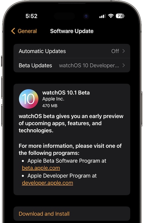 watchos 10.1 beta download