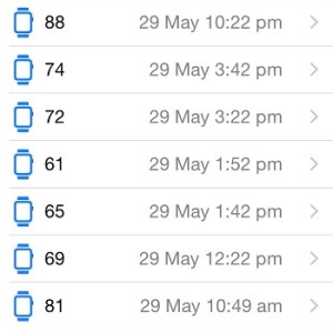apple watch sporadic heart rate measurements