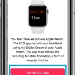 how to set up ecg app on iphone
